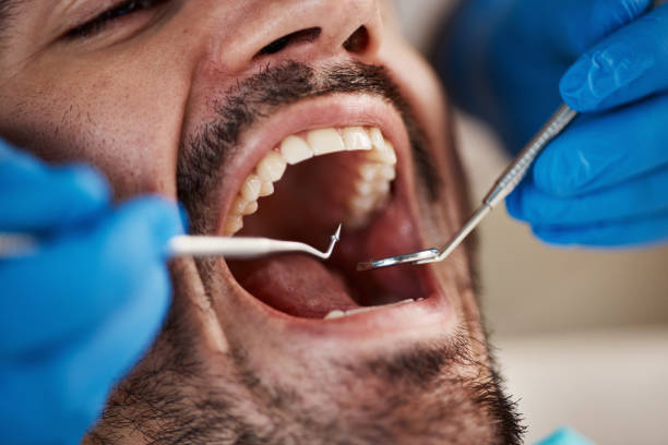 Best Dental Abscess Treatment in New Hope, OR